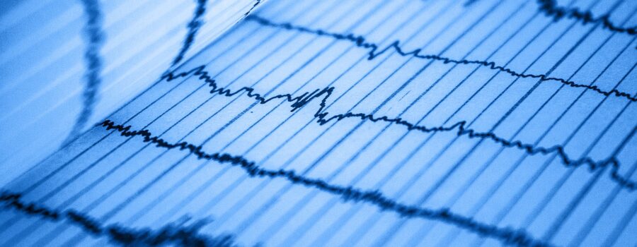 Novel Genetic Signals for Heart Failure Identified
